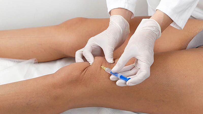 Injection intra-karticulaire à l'arthrose du genou