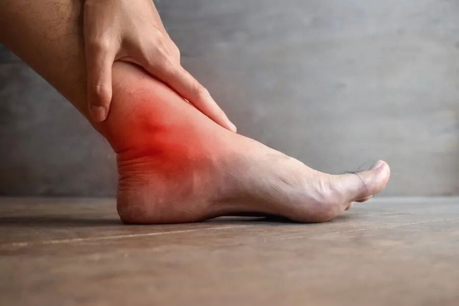 Arthrose de l'articulation de la cheville